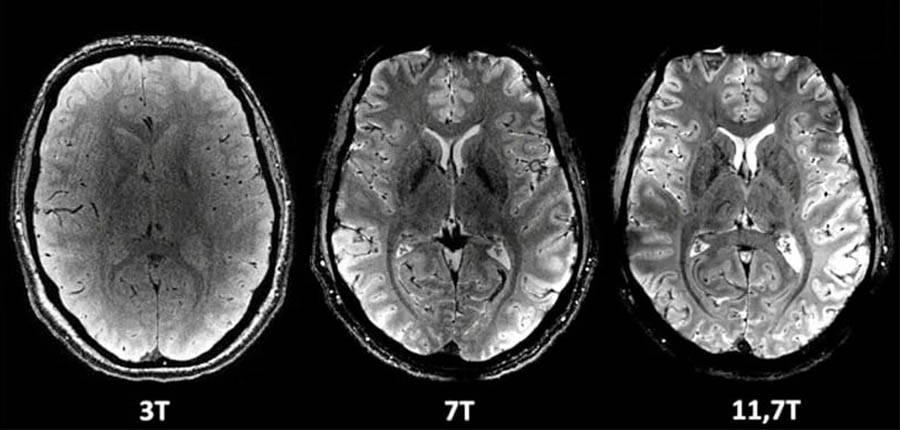 Grâce à un IRM de haute performance, des images inédites du cerveau