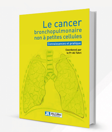 ouvrage livre Le cancer broncho pulmonaire