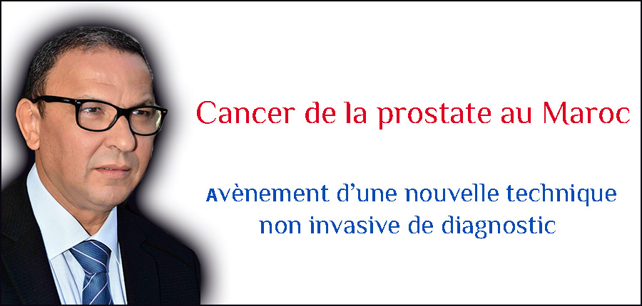 Cancer de la prostate au Maroc : l’avènement d’une nouvelle technique non invasive de diagnostic